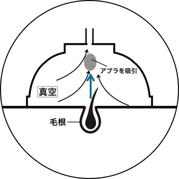 施術工程2