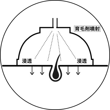 施術工程3